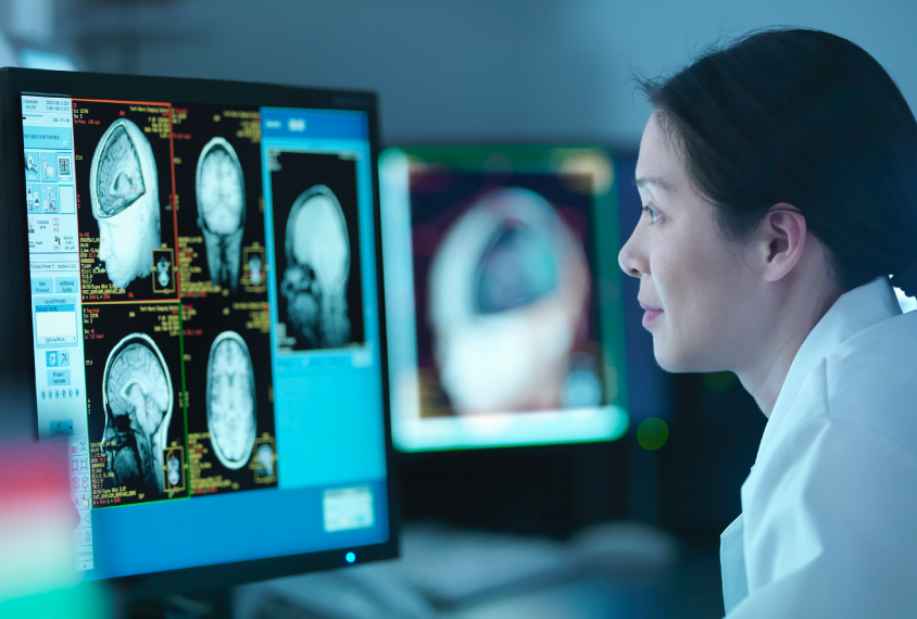Woman in lab coat reviews brain scan images on a computer monitor.