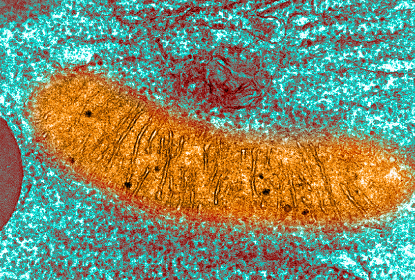 Micrograph of a mitochondria.