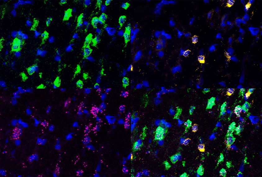 Research image of the posterior insular cortex.