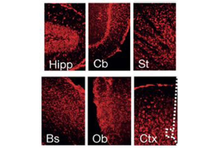 micrographs of brain areas in red.