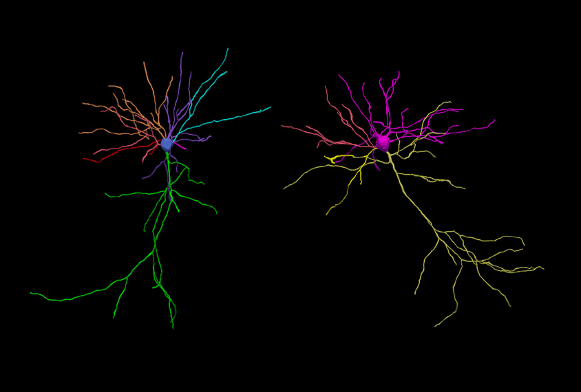 Two colorful mouse neurons seen side by side on black, one has a mutation.