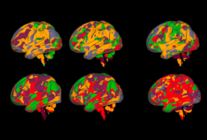 Group of 6 brains show sections colored differently
