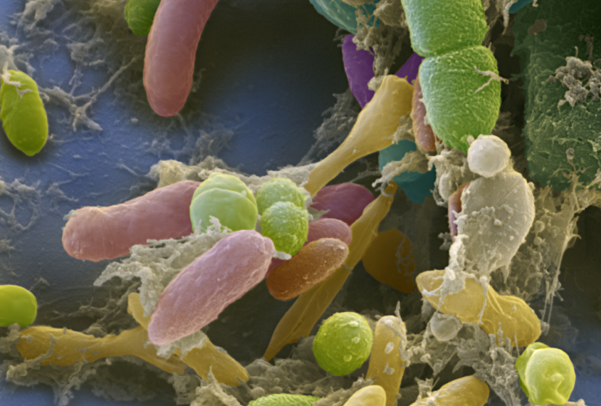 Color enhanced scanning electron micrograph (SEM) of different bacteria from a human fecal sample.