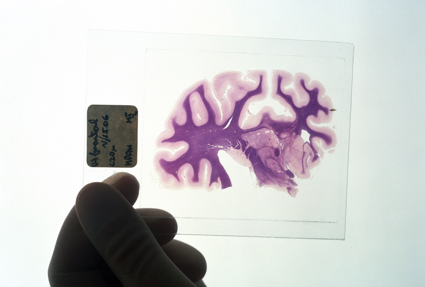 a hand holds a slide of a brain slice against a light white background