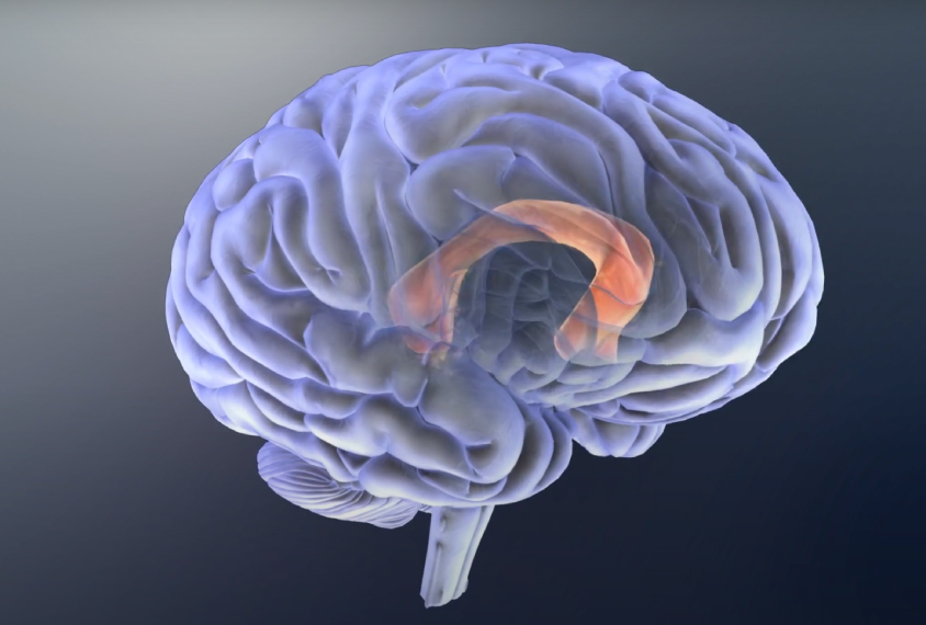 Digital illustration of a brain with the corpus callosum highlighted.