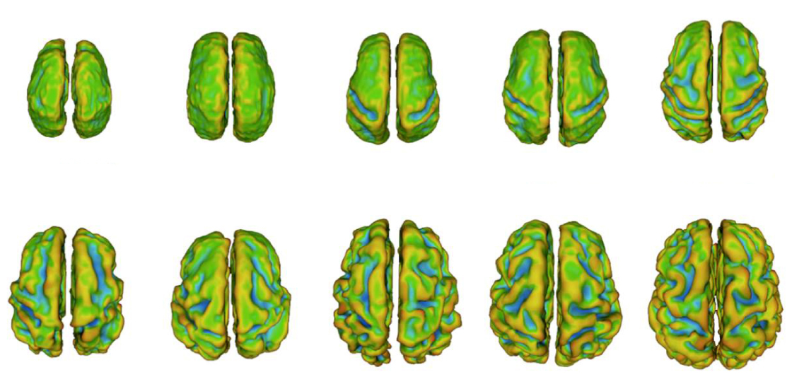 Scans of fetal brains.