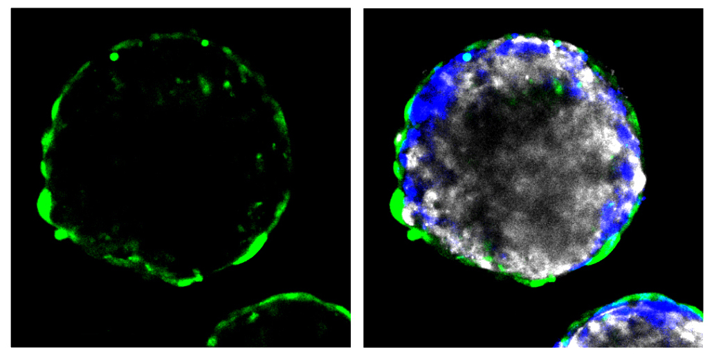 Spheres that mimic the blood-brain barrier are wrapped in endothelial cells (green), which line blood vessels in the brain.