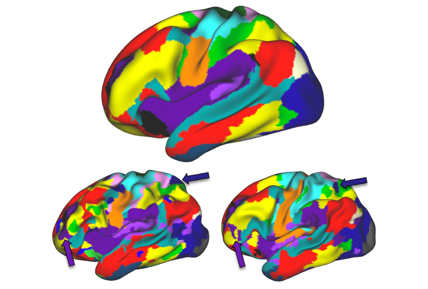 Individual differences in brain structure parallel variations in brain activation when people move their tongue or feet.