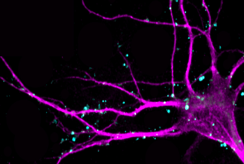 Microscope image of neuronal injections in brain.