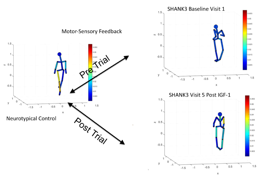 Movement maps of children with Phelan-McDermid syndrome