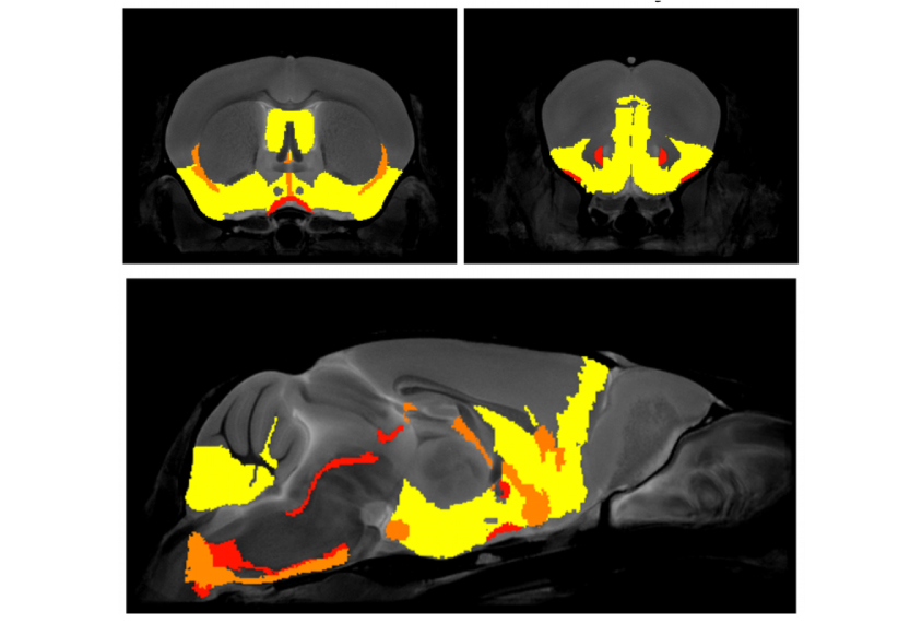 Brain regions (yellow) altered by missing immune genes correlate with those involved in anxiety.