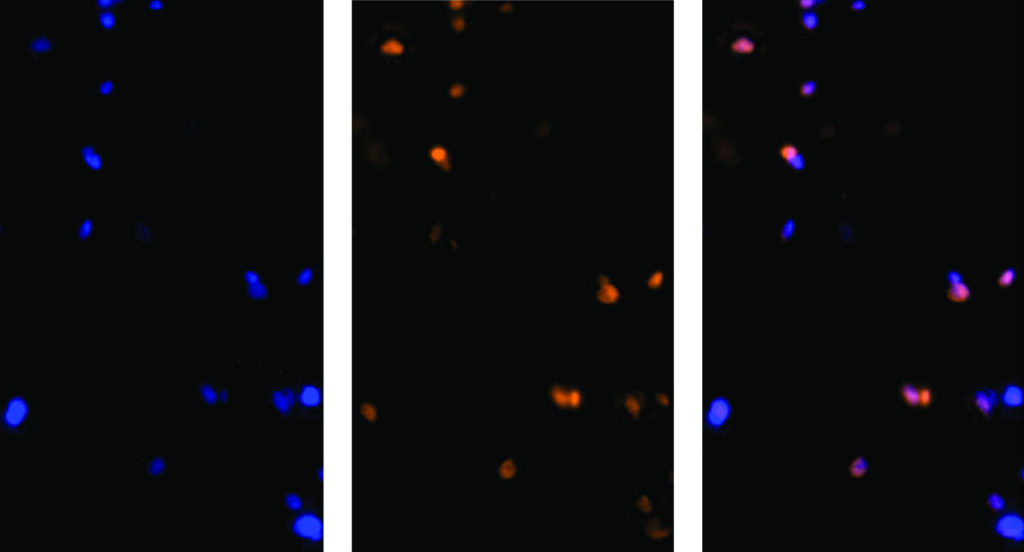 By staining the nuclei from all cells blue (left) and those from neurons red (middle), researchers can isolate the resulting purple nuclei from neurons (right).
