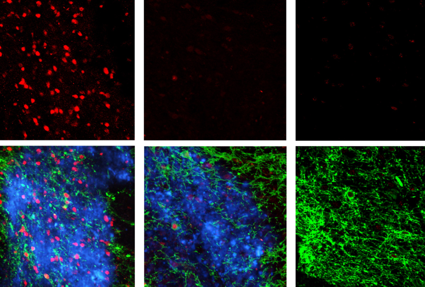 Tiny particles (blue), along with light-sensitive proteins (green) and light, excite neurons (red) in a reward region of the mouse brain.