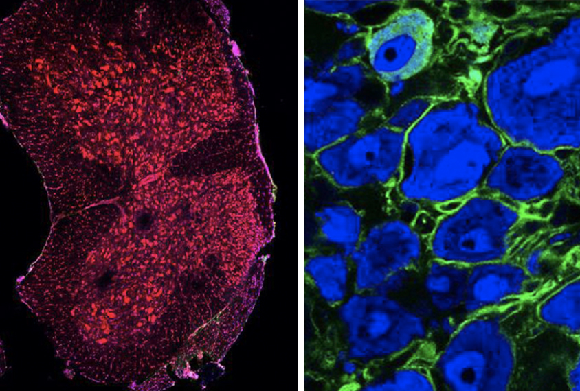 CASPR2 antibodies (green) bind to sensory neurons that send signals to the spinal cord (right) but not to neurons in the spinal cord (left).