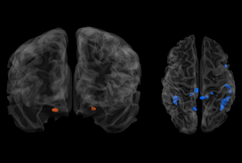 Two brains with sections lit up