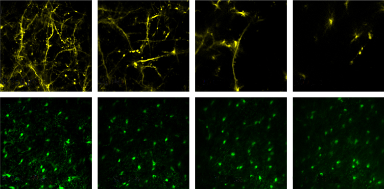 After scientists render a mouse skull transparent, neuron tendrils (top, yellow) and brain immune cells (bottom, green) are visible at various depths.