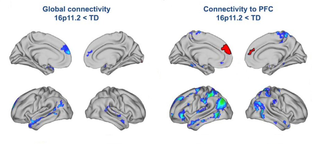 eight brains with various sections highlighted