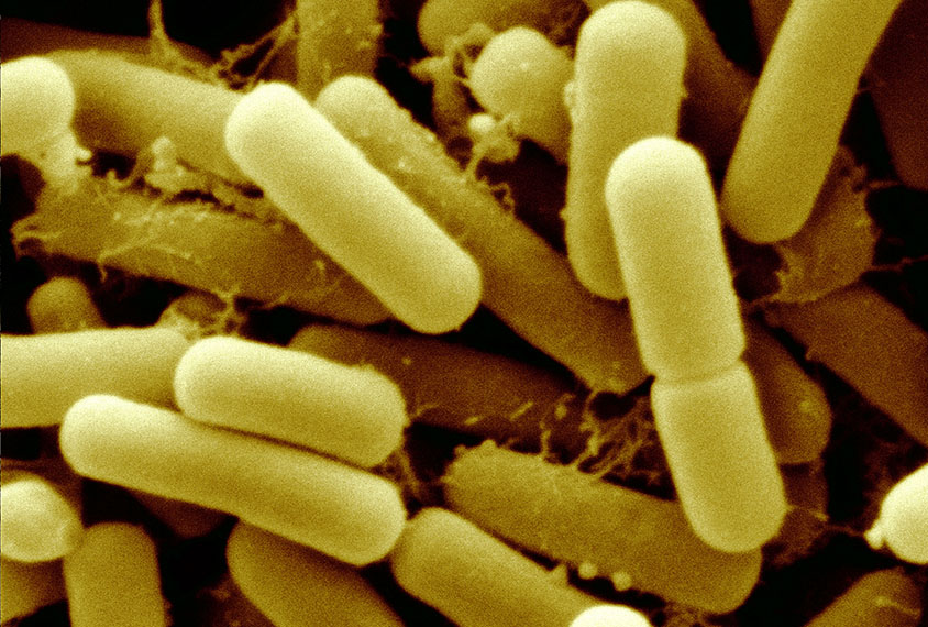 Scanning electron micrograph (SEM) of Lactobacillus reuteri. Lactobacillus reuteri, a probiotic bacterium, is found in breast milk and the human gastrointestinal tract. It is also found in cattle, pigs, chickens, turkeys, mice, hamsters, gerbils, ostriches and rats. This Lactobacillus produces reuterin which suppresses pathogens in the guts.