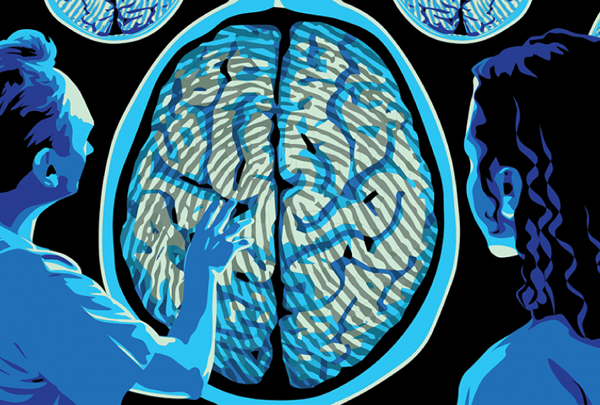 Two doctors look at a brain scan with a 'fingerprint' pattern over the grey matter area.