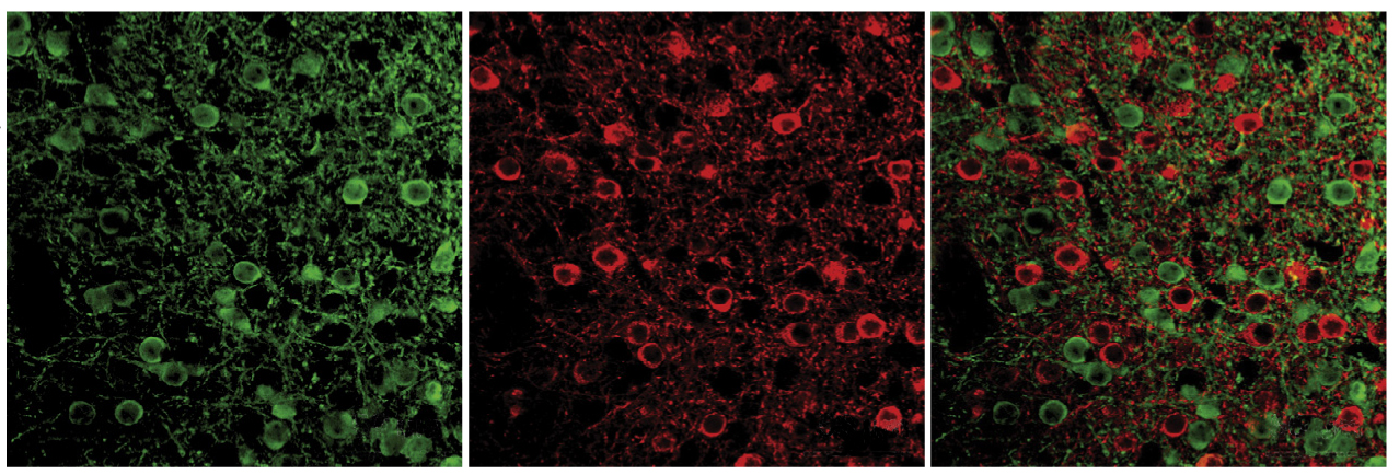 neurons glow red or green, indicating how they work to control movements in mice