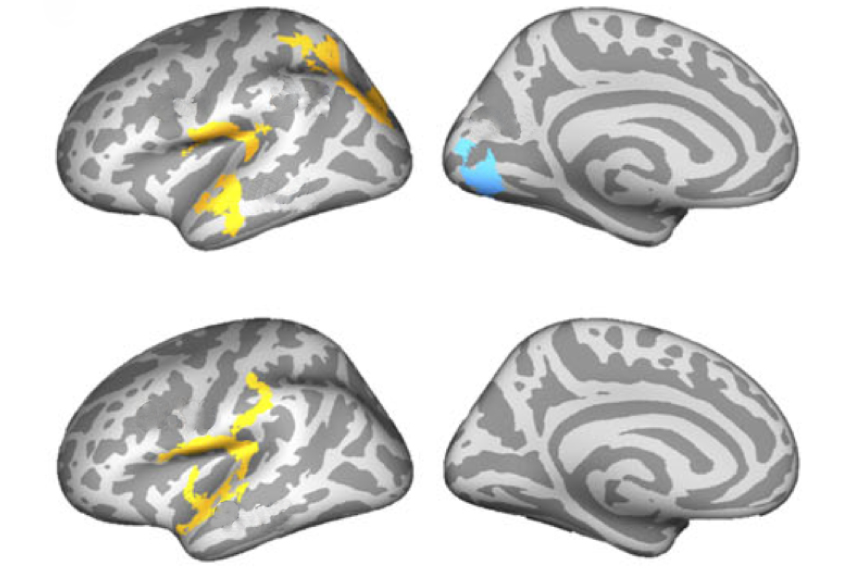 Four brains showing some regions yellow and some blue.