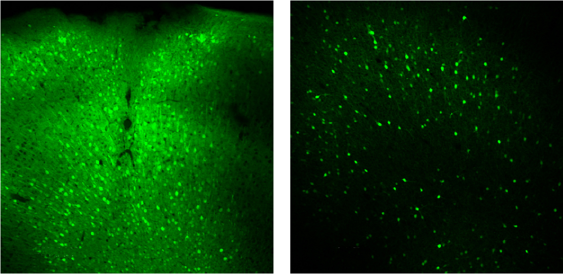 Neurons glow green in a mouse brain.