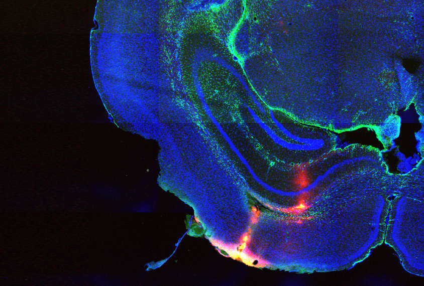 Mouse brain photograph shows the area of drug delivery highlighted in red.