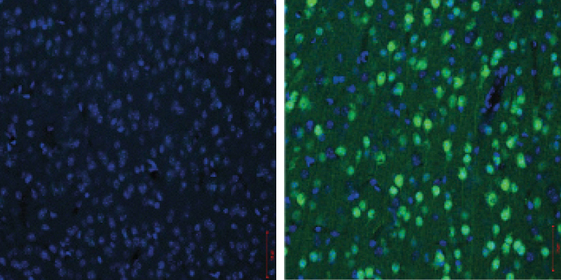 Mouse brain slices glow green and blue in microscope view.