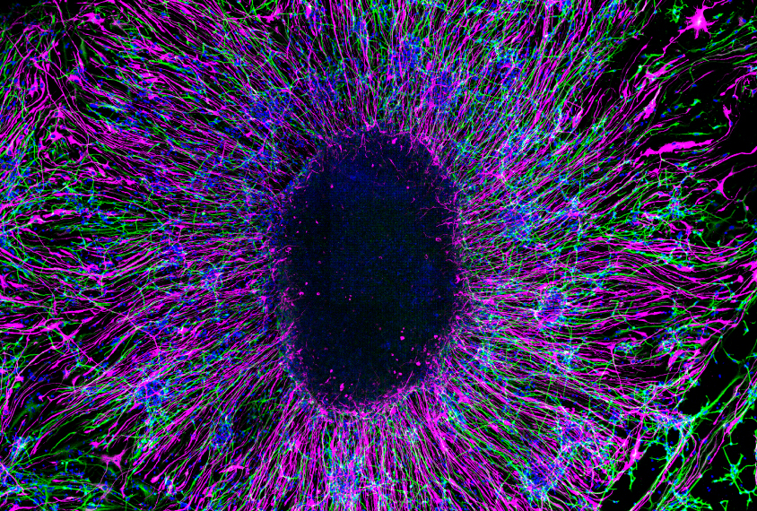 Neurons in lab grown brain glow green, red and blue.
