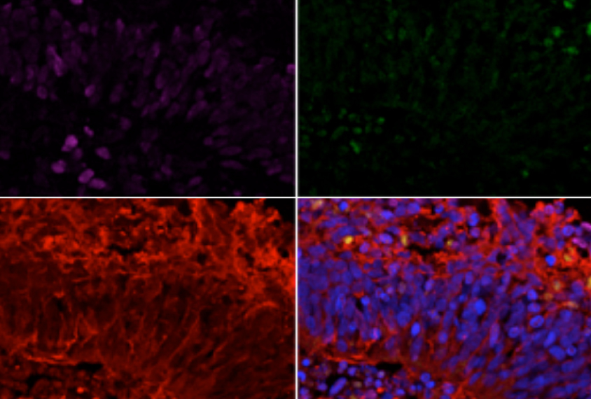 Brain cells under magnification glow red, purple and blue.