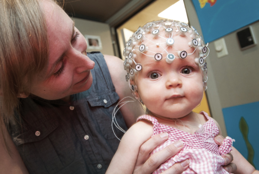 Baby with EEG cap looks at camera.