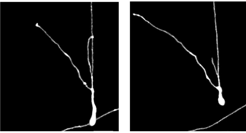 Black and white images shows human neurons grafted onto a mouse brain grow over time.