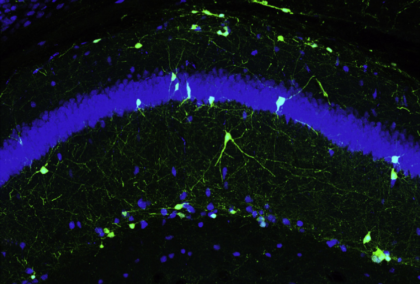 Neurons glow green in mice brain.