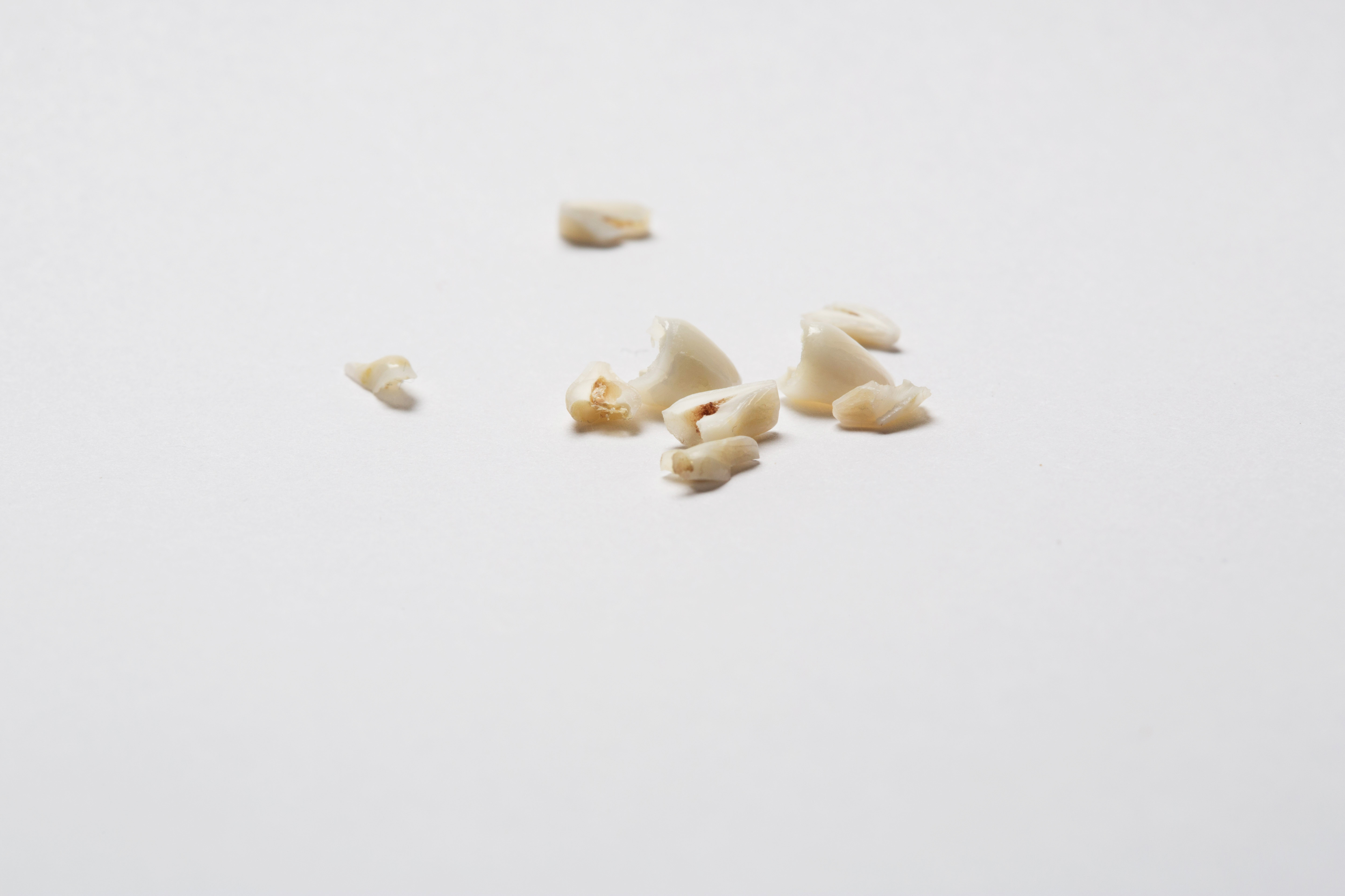 Photo: A close-up of a baby teeth strewn about.