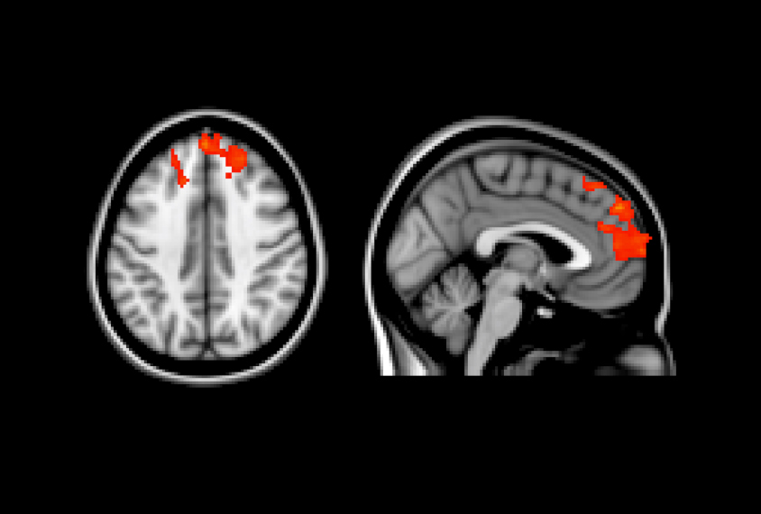 Images of the human brain