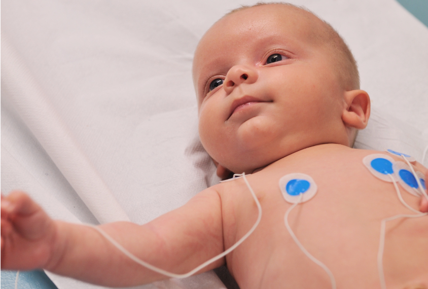 Baby with sensors on it's chest for an EKG, or ECG