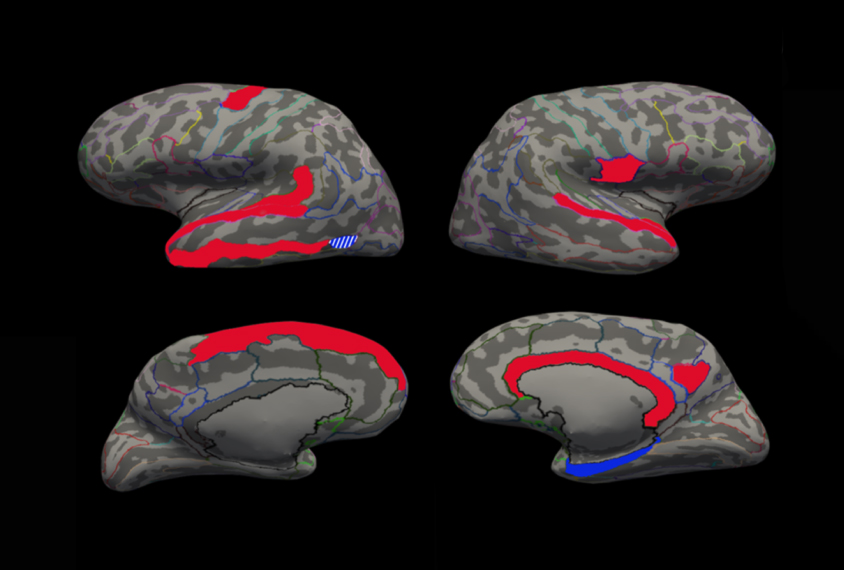 3D models of the human brain
