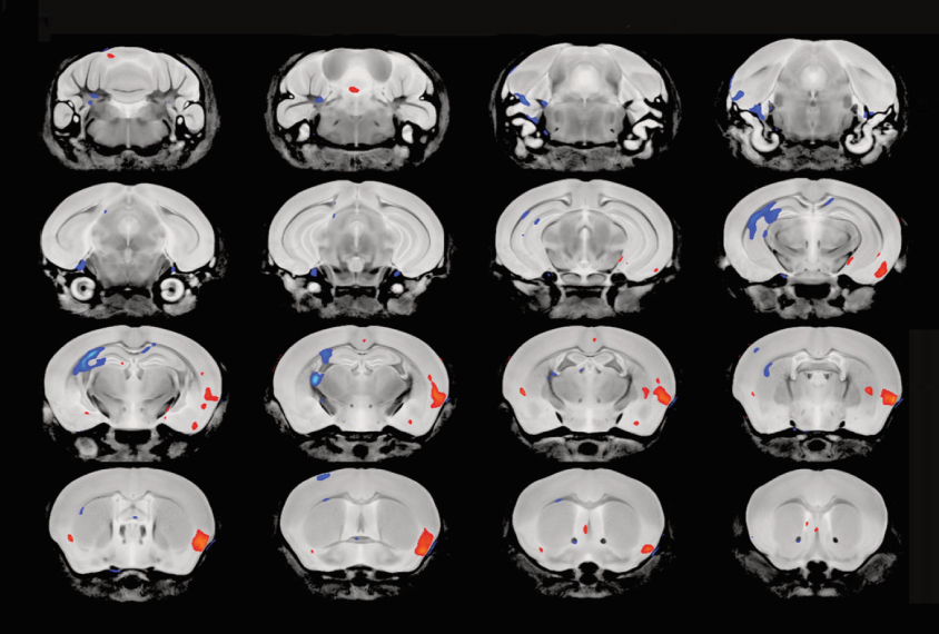 A series of 3D mouse brains