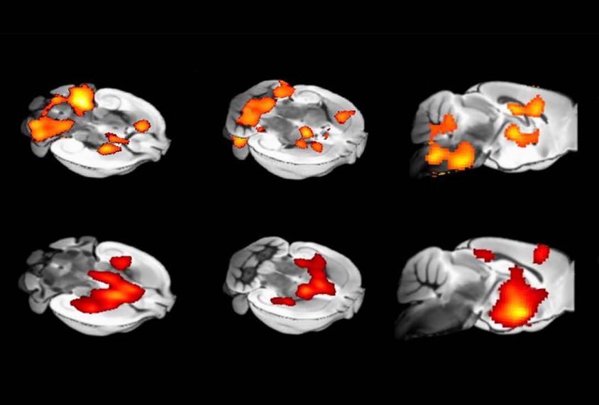 Color-coded mouse brain scans