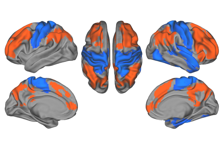 Human brain seen in four views