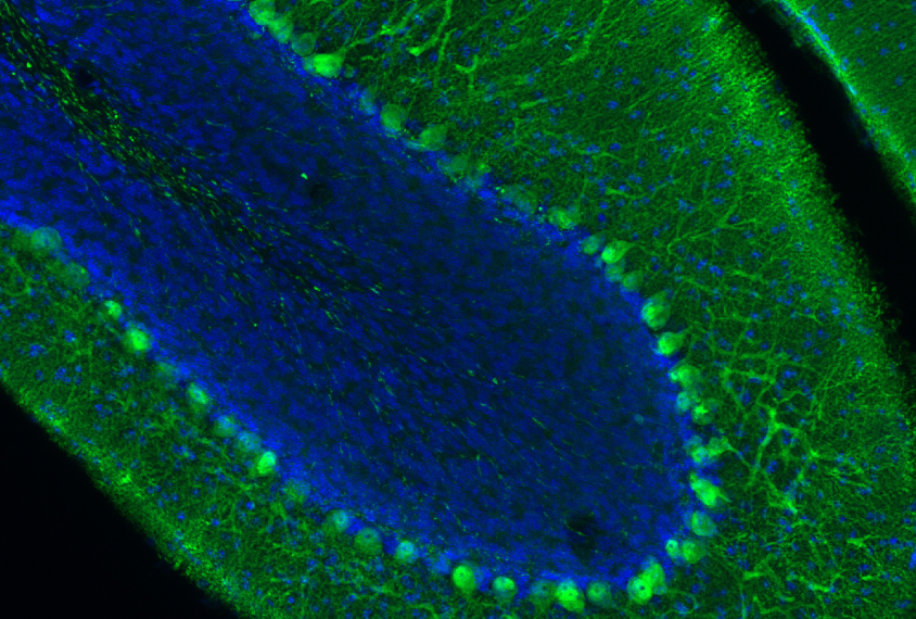neurons in mice brains