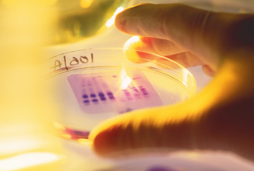 Genome sequence. The pattern of bands represents the chemical sequence that forms the genetic code for a section of DNA (deoxyribonucleic acid). The DNA sample was cut into fragments by an enzyme. These fragments were then placed into a gel in the petri dish and separated by electrophoresis, the application of an electric charge. DNA sequencing is used in forensic science, medical research and genealogy.