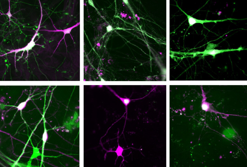 grid of lab grown neurons