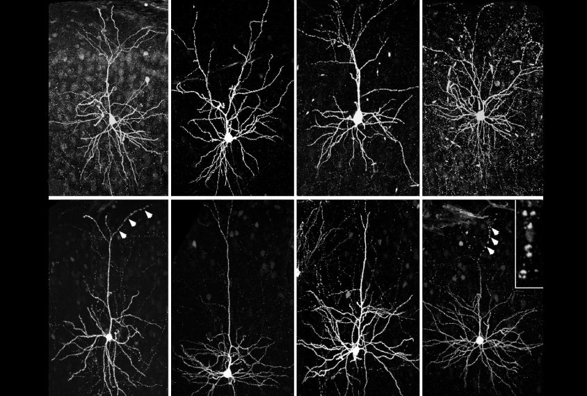Mouse neurons in a grid show differences