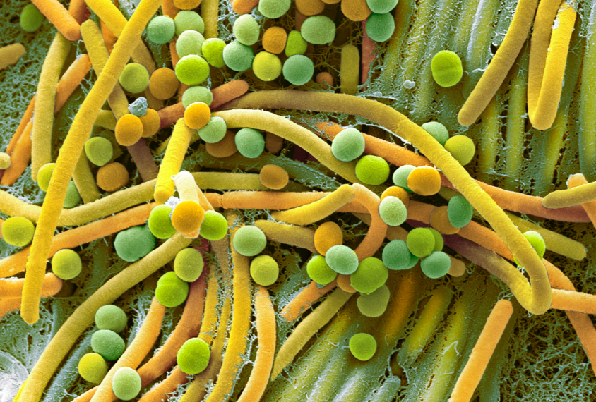 Micrograph of fecal bacteria