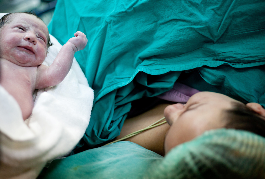 Woman looks at her newborn from under the operating tent of c-section surgery