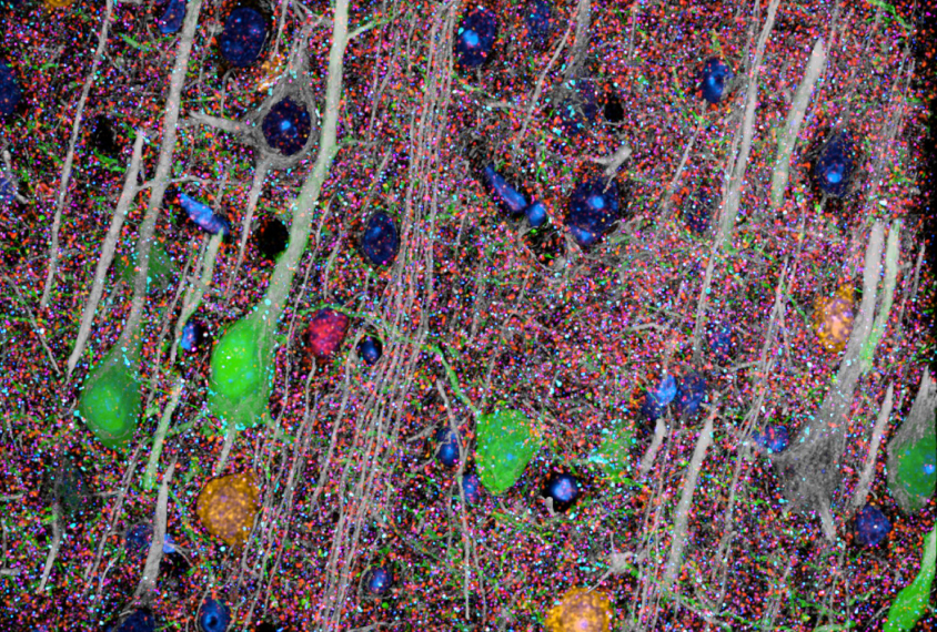 synapse populations analysis--micrograph shows neurons in green in colorful network