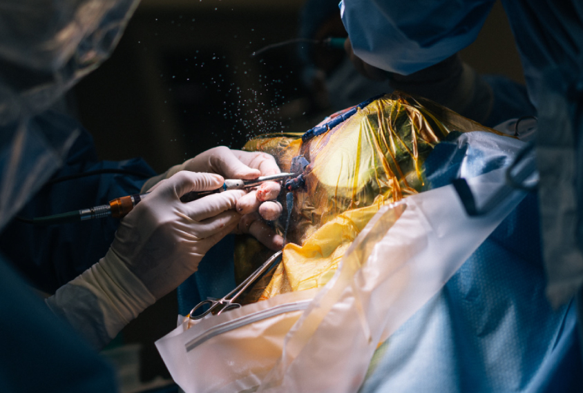 medical personnel in operating theater during brain surgery