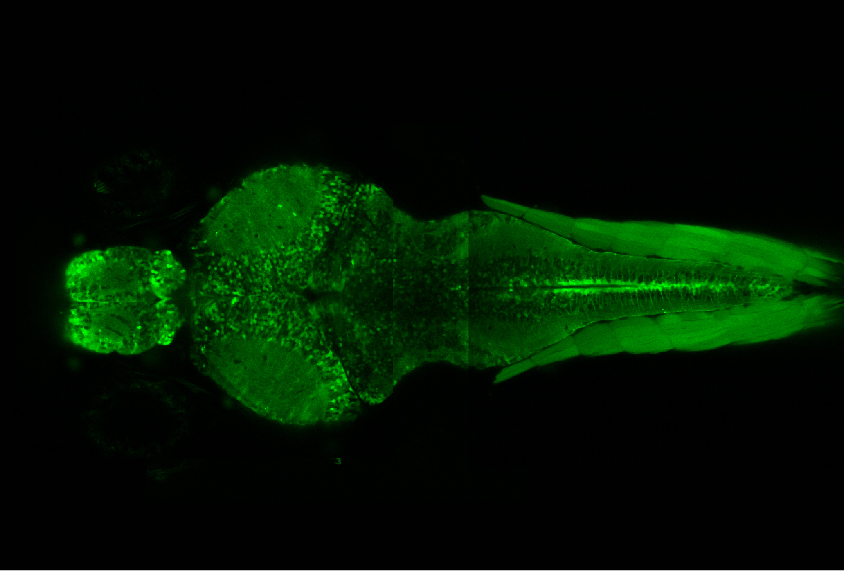 Glowing neurons in the transparent young zebrafish highlight activity in its brain and muscles.