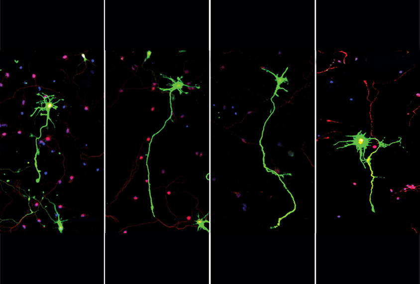 four panels show mouse neurons showing abnormalities